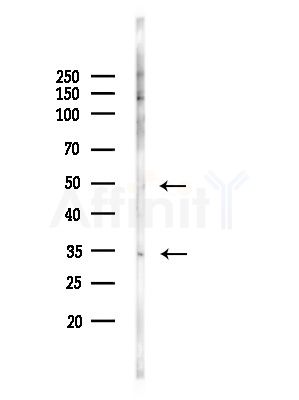 NEUROD1 Antibody - Western blot analysis of lysates from A375 cells(LPS, 4h treatment), using NEUROD1 Antibody at 1/1000 dilution.
