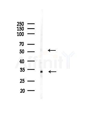 NEUROD1 Antibody - Western blot analysis of lysates from RAW264.