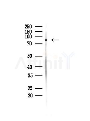 MAD1L1 Antibody - Western blot analysis of lysates from MDA-MB-231 cells(heat-shock,45min treatment), using MAD1L1 Antibody at 1/1000 dilution.