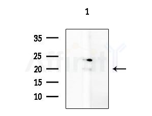 BCL2L2 Antibody - Western blot analysis of extracts from Mouse liver, using BCL2L2 Antibody at 1/1000 dilution.