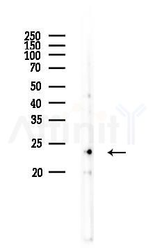 BCL2L2 Antibody - Western blot analysis of lysates from Mouse liver, using BCL2L2 Antibody at 1/1000 dilution.