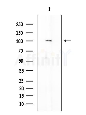 alpha-Actinin Antibody - Western blot analysis of extracts from COLO205 cells, using alpha-Actinin Antibody at 1/1000 dilution.