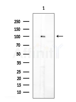 alpha-Actinin Antibody - Western blot analysis of extracts from Mouse liver, using alpha-Actinin Antibody at 1/1000 dilution.