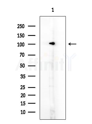 alpha-Actinin Antibody - Western blot analysis of extracts from HUVEC cells, using alpha-Actinin Antibody at 1/1000 dilution.