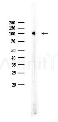 alpha-Actinin Antibody - Western blot analysis of lysates from HUVEC cells, using alpha-Actinin Antibody at 1/1000 dilution.