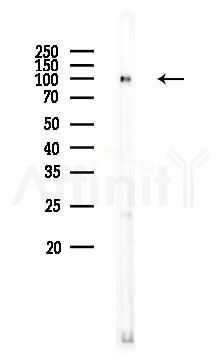 alpha-Actinin Antibody - Western blot analysis of lysates from Mouse liver, using alpha-Actinin Antibody at 1/1000 dilution.