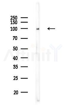 alpha-Actinin Antibody - Western blot analysis of lysates from COLO205 cells, using alpha-Actinin Antibody at 1/1000 dilution.