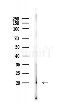RHEB Antibody - Western blot analysis of lysates from LoVo cells(heat-shock,45min treatment), using RHEB Antibody at 1/1000 dilution.