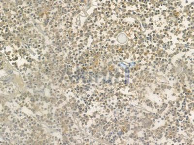 TMS1/ASC Antibody - DF6304 at 1/100 staining human pituitary adenoma by IHC-P.