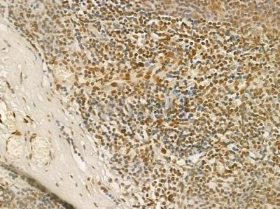 Rel Antibody - DF6315 at 1/100 staining human normal tonsil tissue by IHC-P.