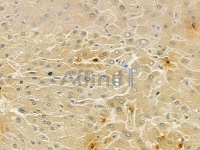 Calmodulin1/2/3 Antibody - DF6319 at 1/100 staining human normal liver tissue by IHC-P.