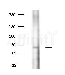 GGA2 Antibody - Western blot analysis of lysates from Mouse liver, using GGA2 Antibody at 1/1000 dilution.