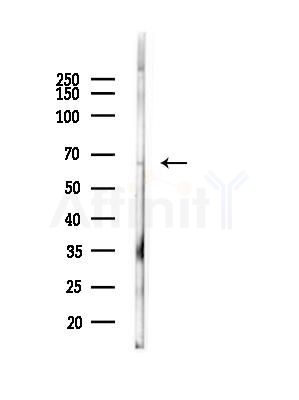 GGA2 Antibody - Western blot analysis of lysates from Mouse liver, using GGA2 Antibody at 1/1000 dilution.