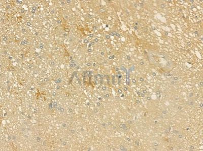 KRAS Antibody - DF6324 at 1/100 staining human pituitary adenoma by IHC-P.