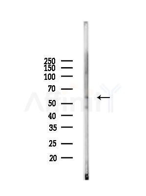 HGF Antibody - Western blot analysis of lysates from Rat lung, using HGF Antibody at 1/1000 dilution.
