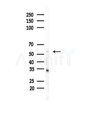 FCGR1A Antibody - Western blot analysis of lysates from COLO205 cells(heat-shock,45min treatment), using FCGR1A Antibody at 1/1000 dilution.