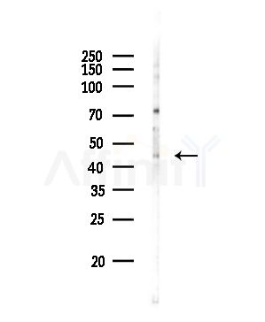 WT1 Antibody - Western blot analysis of lysates from Rat brain, using WT1 Antibody at 1/1000 dilution.