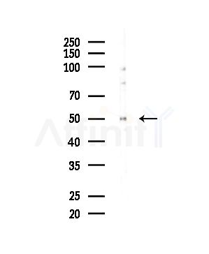 WT1 Antibody - Western blot analysis of lysates from HepG2 cells, using WT1 Antibody at 1/1000 dilution.
