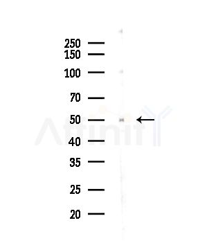 WT1 Antibody - Western blot analysis of lysates from COLO205 cells(UV,30min treatment), using WT1 Antibody at 1/1000 dilution.