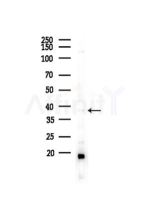 RASSF1 Antibody - Western blot analysis of lysates from COLO205 cells(UV,30min treatment), using RASSF1 Antibody at 1/1000 dilution.