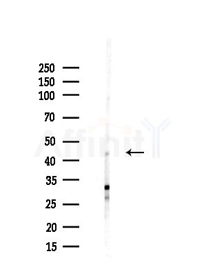 SCRN2 Antibody - Western blot analysis of lysates from HUVEC cells(starvation,24h treatment), using SCRN2 Antibody at 1/1000 dilution.