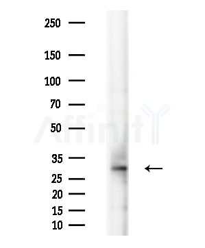 GSTM2 Antibody - Western blot analysis of lysates from EC304 cells(heat-shock,45min treatment), using GSTM2 Antibody at 1/1000 dilution.