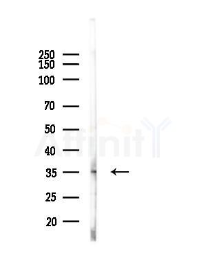 GSTM2 Antibody - Western blot analysis of lysates from EC304 cells(heat-shock,45min treatment), using GSTM2 Antibody at 1/1000 dilution.