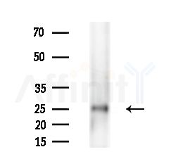 CA3 Antibody - Western blot analysis of extracts from Rat brain, using CA3 Antibody at 1/1000 dilution.