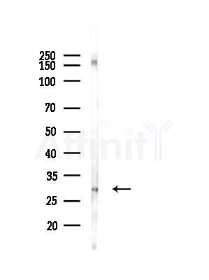CA3 Antibody - Western blot analysis of lysates from Rat brain, using CA3 Antibody at 1/1000 dilution.