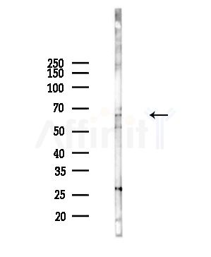 NET1 Antibody - Western blot analysis of lysates from Hela cells(heat-shock,45min treatment), using NET1 Antibody at 1/1000 dilution.