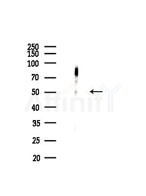 SRPX Antibody - Western blot analysis of lysates from Mouse brain, using SRPX Antibody at 1/1000 dilution.