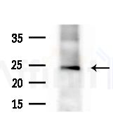 AK1 Antibody - Western blot analysis of lysates from various samples, using AK1 Antibody at 1/1000 dilution.