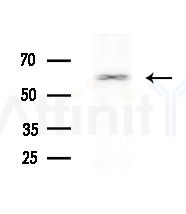 STIP1 Antibody - Western blot analysis of lysates from various samples, using STIP1 Antibody at 1/1000 dilution.