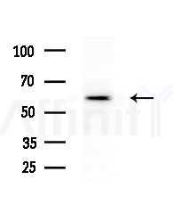 STIP1 Antibody - Western blot analysis of lysates from RAW264.