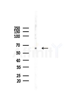 STIP1 Antibody - Western blot analysis of lysates from HepG2 cells(LPS,4h treatment), using STIP1 Antibody at 1/1000 dilution.