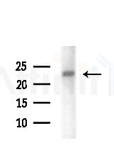 ITPA Antibody - Western blot analysis of lysates from Mouse brain, using ITPA Antibody at 1/1000 dilution.