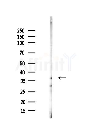 AKR7A2 Antibody - Western blot analysis of lysates from HUVEC cells(starvation,24h treatment), using AKR7A2 Antibody at 1/1000 dilution.