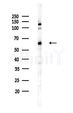 AMPK alpha Antibody - Western blot analysis of lysates from RAW264.