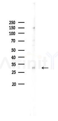 KLRC1 Antibody - Western blot analysis of lysates from HUVEC cells, using KLRC1 Antibody at 1/1000 dilution.