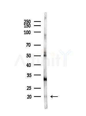 PLA2G2A Antibody - Western blot analysis of lysates from B16F10-LUC cells(starvation,24h treatment), using PLA2G2A Antibody at 1/1000 dilution.