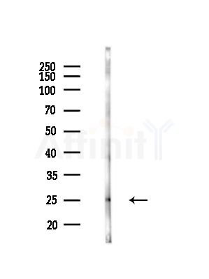 PSMA3 Antibody - Western blot analysis of lysates from Mouse brain, using PSMA3 Antibody at 1/1000 dilution.