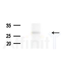 GSTT1 Antibody - Western blot analysis of lysates from Rat liver, using GSTT1 Antibody at 1/1000 dilution.