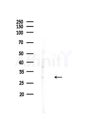GSTT1 Antibody - Western blot analysis of lysates from Rat liver, using GSTT1 Antibody at 1/1000 dilution.