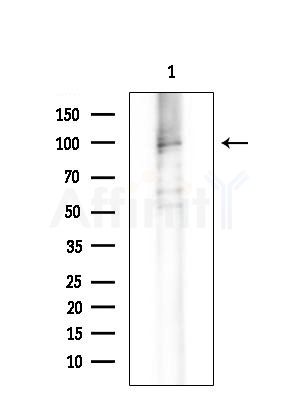 PTPN22 Antibody - Western blot analysis of extracts from B16F10-LUC cells(heat-shock treatment), using PTPN22 Antibody at 1/1000 dilution.
