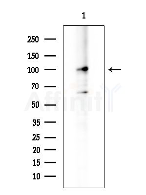 PTPN22 Antibody - Western blot analysis of extracts from Hela cells(LPS 4h treatment), using PTPN22 Antibody at 1/1000 dilution.