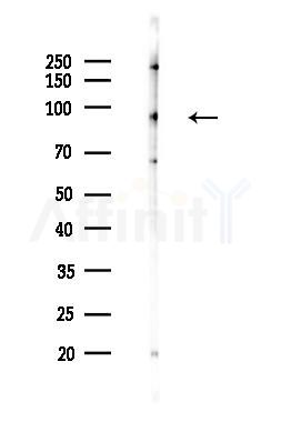 PTPN22 Antibody - Western blot analysis of lysates from Hela cells(LPS 4h treatment), using PTPN22 Antibody at 1/1000 dilution.