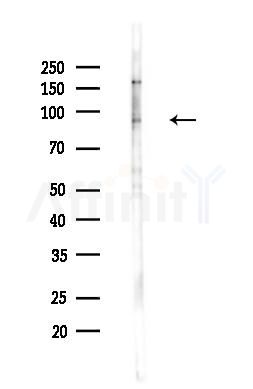 PTPN22 Antibody - Western blot analysis of lysates from B16F10-LUC cells(heat-shock,45min treatment), using PTPN22 Antibody at 1/1000 dilution.