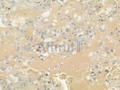 LIPC Antibody - DF6411 at 1/100 staining human normal lung tissue by IHC-P.