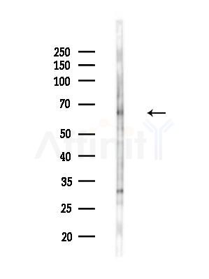 SHP1 Antibody - Western blot analysis of lysates from EC304 cells(heat-shock treatment), using SHP1 Antibody at 1/1000 dilution.