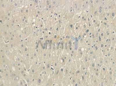 Factor X Antibody - DF6416 at 1/100 staining human normal liver tissue by IHC-P.